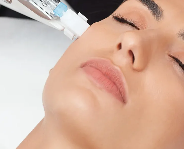 profhilo-behandeling-eindhoven | Cosmedisch Cliënte krijgt skinbooster gelaat door arts van cosmedisch.com
