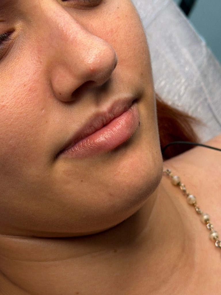 Close-up van een vrouwelijk gezicht met een neutrale uitdrukking en volle lippen.
